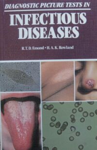 Miniatura okładki Emond R.T.D., Rowland H.A.K. Diagnostic picture tests in infectious diseases.
